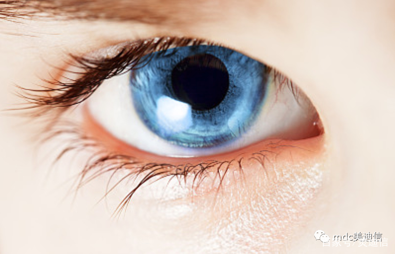 Can IPL be used to treat dry eyes after myopia surgery?