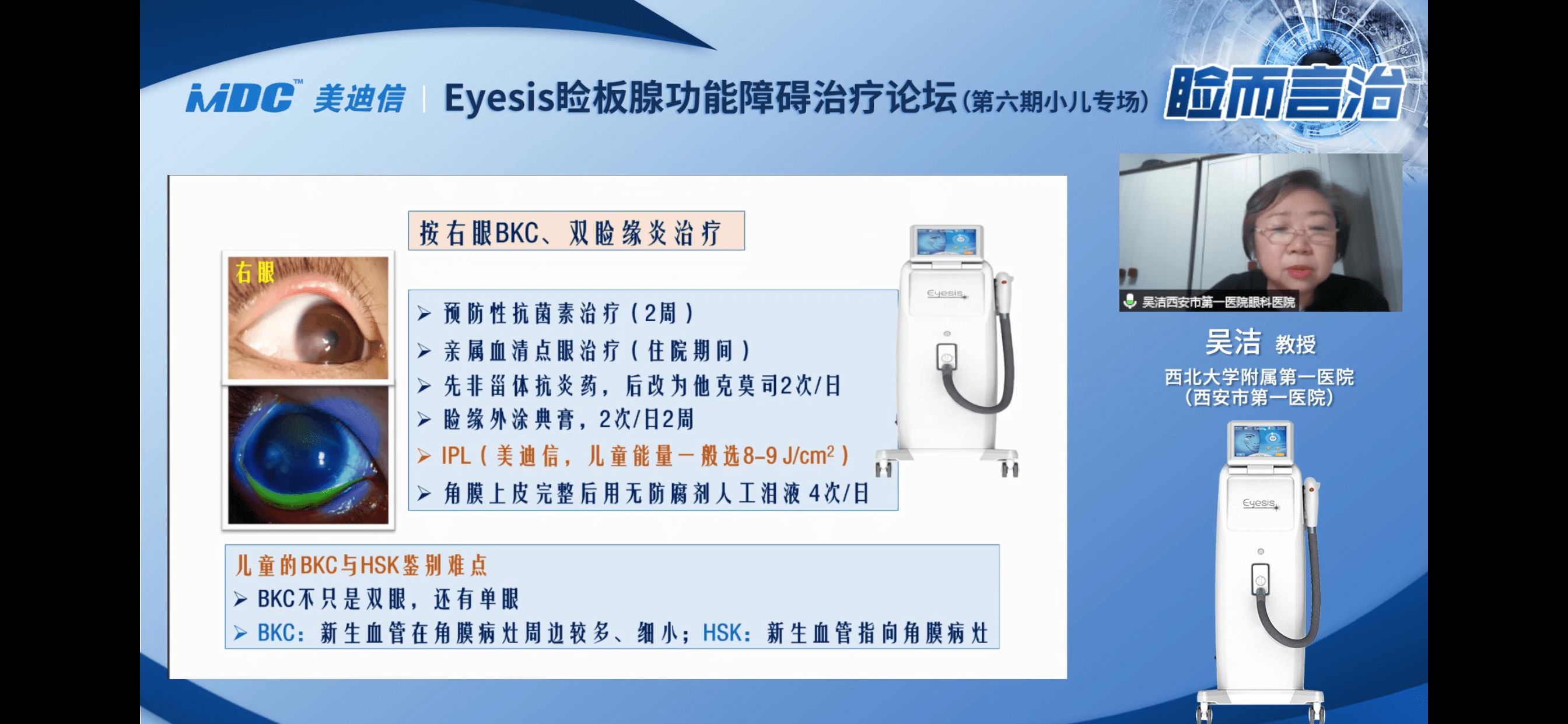 IPL治疗儿童干眼、BKC最新研究及分析（睑而言治·Eyesis干眼治疗第六期论坛）