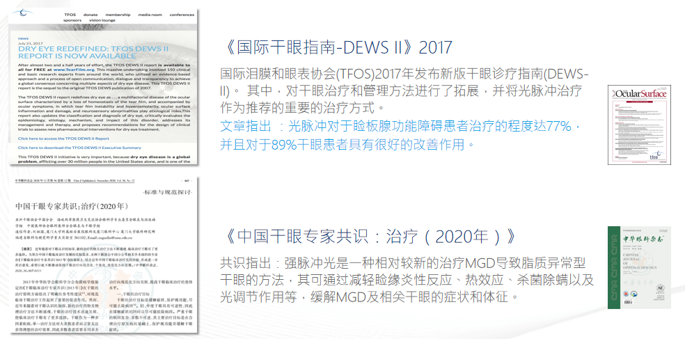 规范使用IPL强脉冲光干眼治疗仪