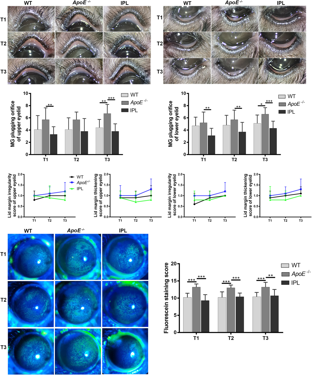 Indirect Application of IPL Induces Therapeutic Effects on Experimental Murine MGD