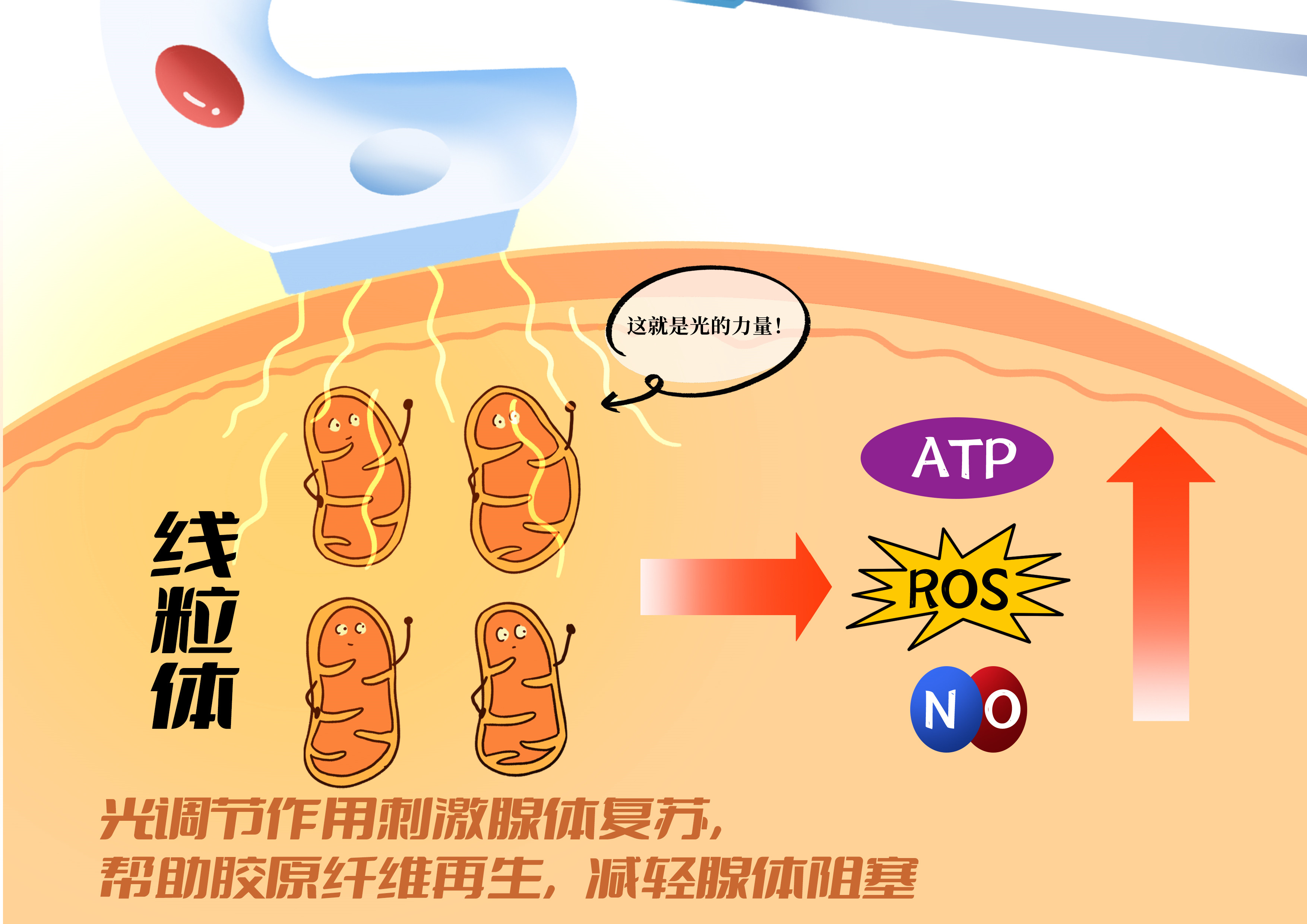 美迪信强脉冲光的光生物调节作用能改善及恢复部分睑板腺腺体再生