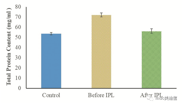 IPL治疗前后的泪液蛋白浓度