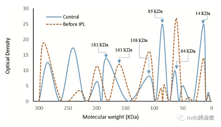 IPL治疗后泪液蛋白的扫描模式