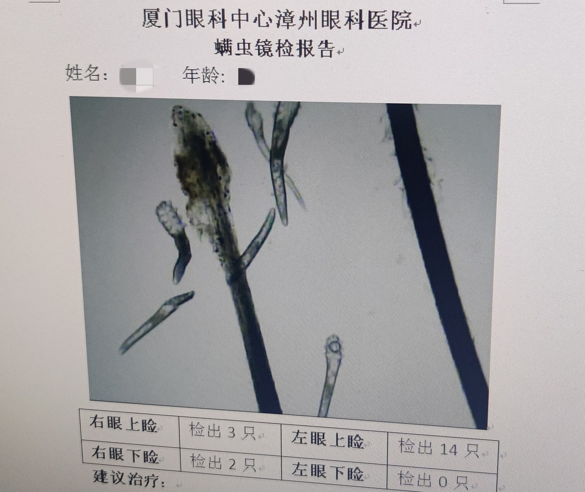 螨虫检查