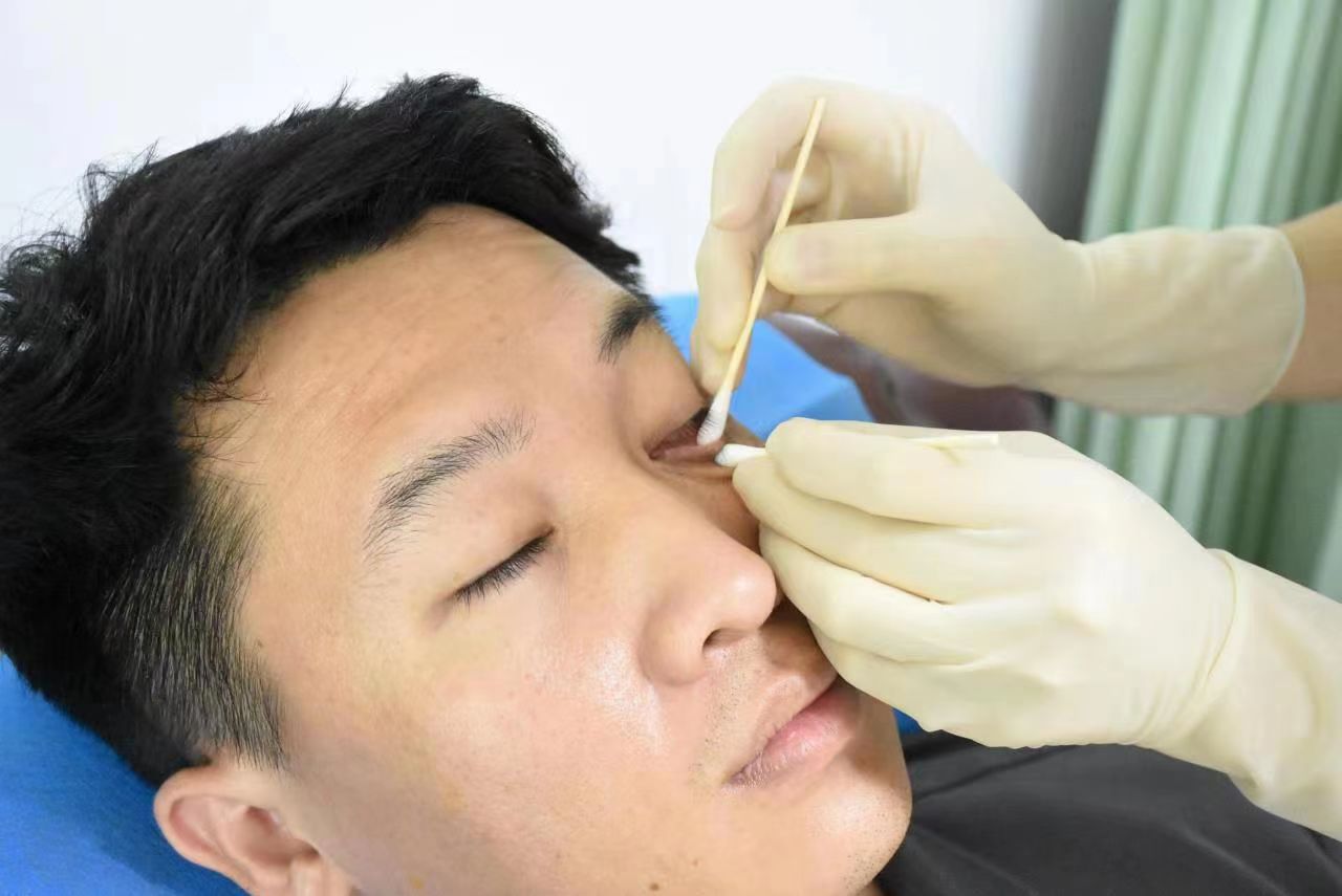 睑板腺按摩