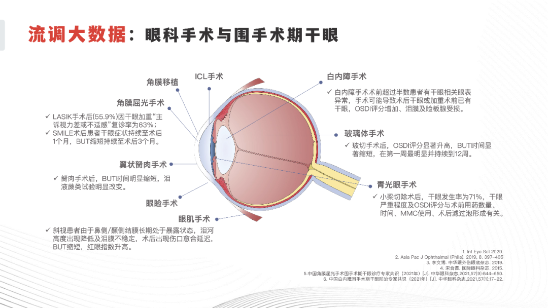 眼科手术和围手术期干眼