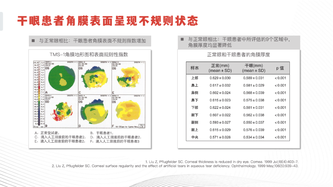 干眼患者角膜表面